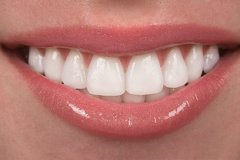 Diş Sağlığında Doğru Bilinen Yanlışlar Diş Hekimi Mehmet Kazandı
