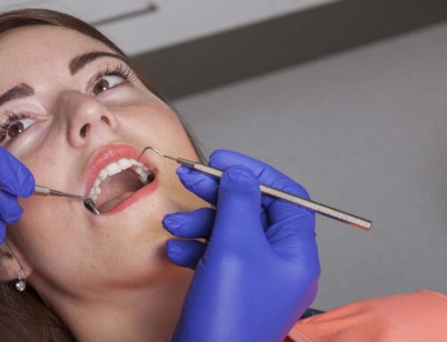 Vorteile von Zirkon-Zähnen