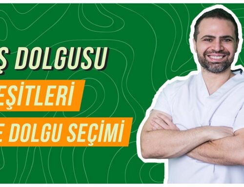 Diş Dolgusu Çeşitleri ve Dolgu Seçimi