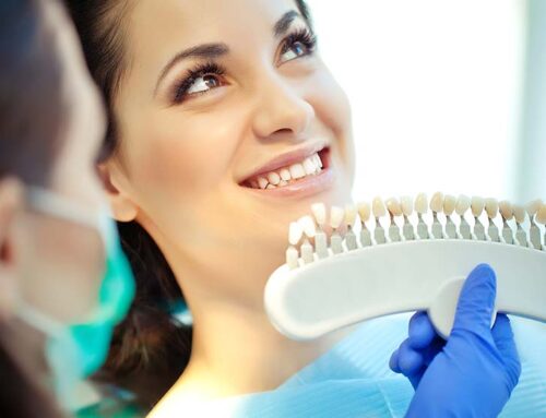 What is Full Ceramic Crown and on Which Teeth is it Applied?